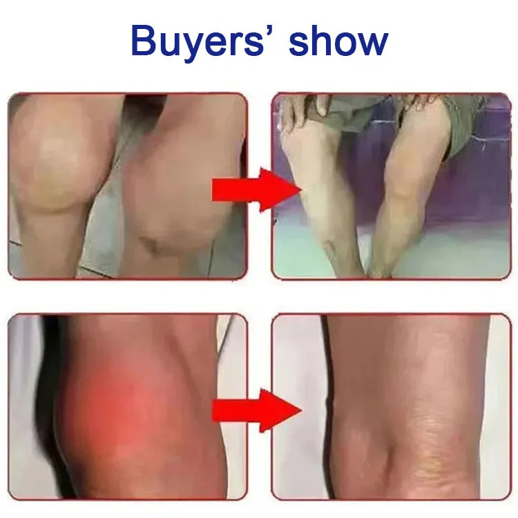 🔥Natural Pain Relief Patches🔥-Herbal Joint Care Patch for Relieving Pain, Swelling, Strain and Sprain
